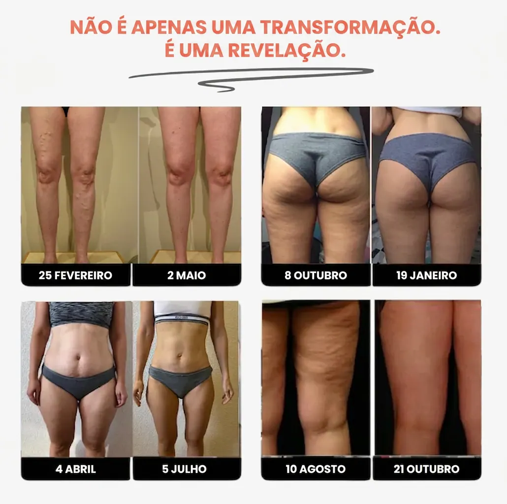 Legging 3D Preferida – Resultado visível em 15 dias — foto 4