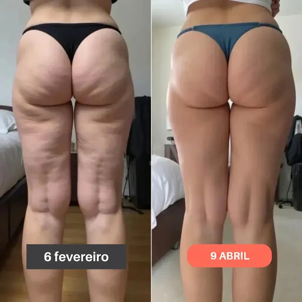 Legging 3D Preferida – Resultado visível em 15 dias — foto 5