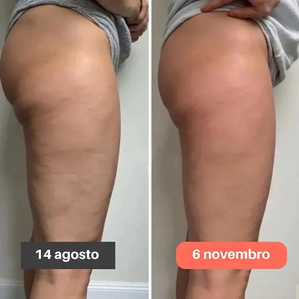 Legging 3D Preferida – Resultado visível em 15 dias — foto 6