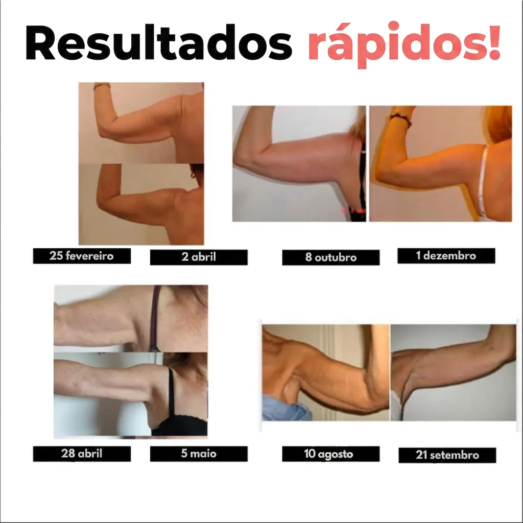Mangas 3D Modeladoras – Adeus braços flácidos em 15 dias — foto 4